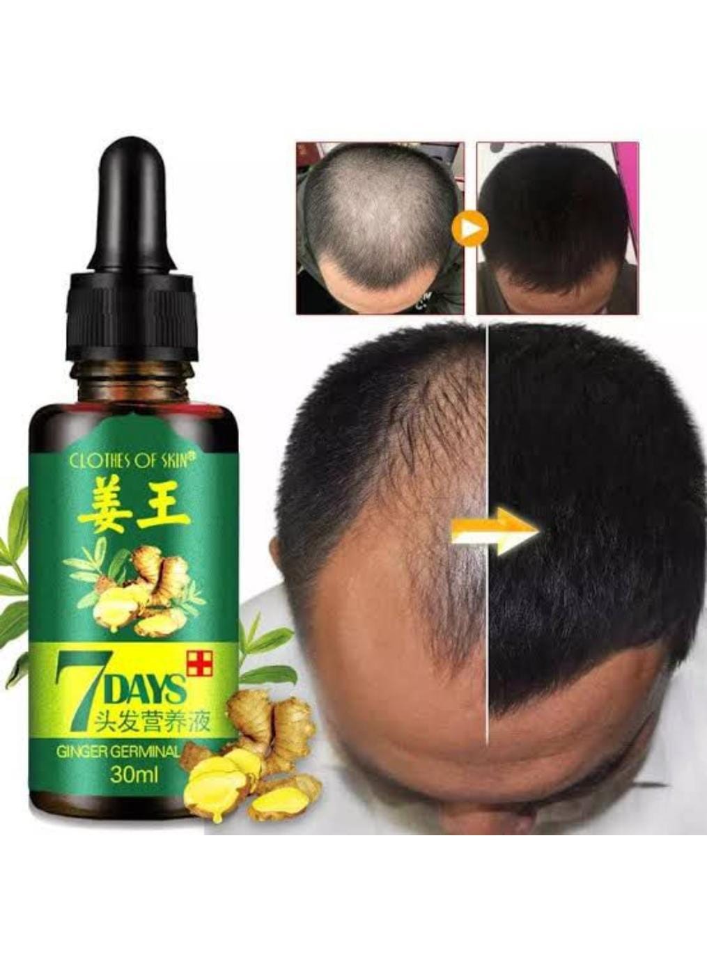 Nourishing hair growth serum bottle – 30ml